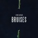 Lewis Capaldi: Bruises